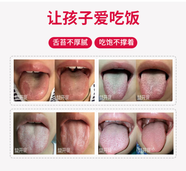 益開食雞內金山楂六物膏 (2).jpg