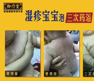 御療堂藥浴反饋圖